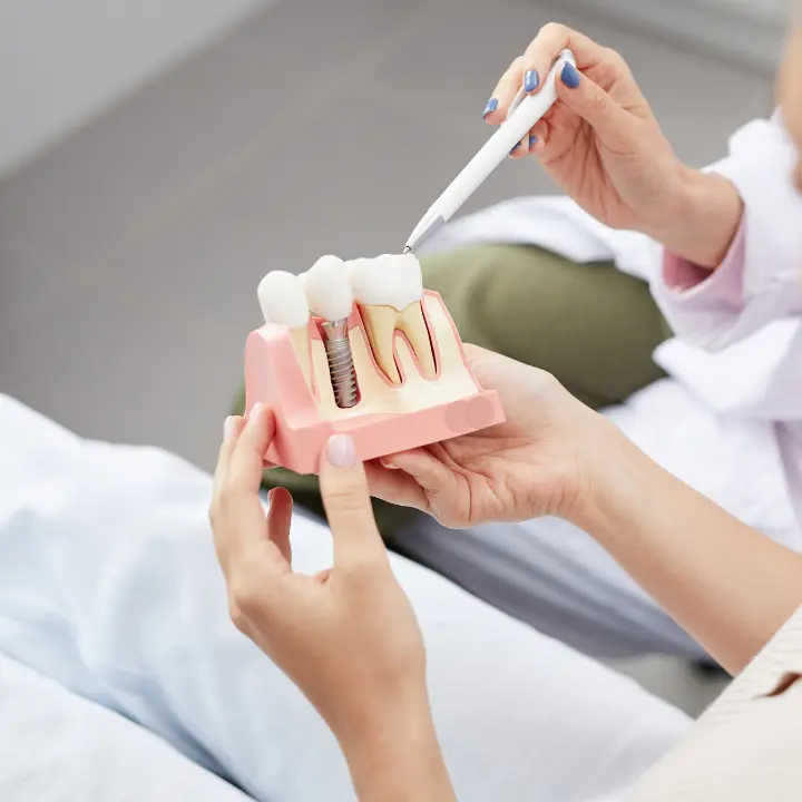 AnyConv.com__IMPLANTES